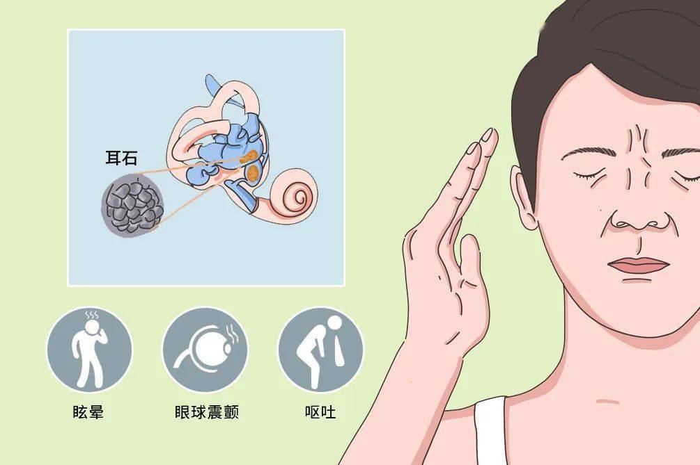 耳石症是怎么引起的？