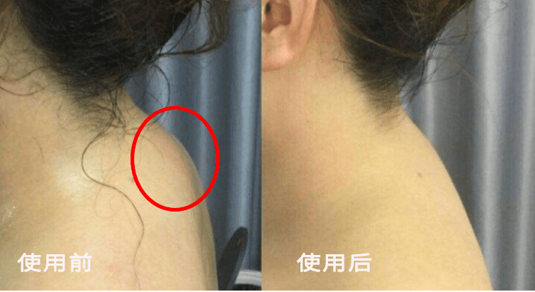 一扭脖子咔咔响?爆款神器让你疲劳一扫光～_颈椎