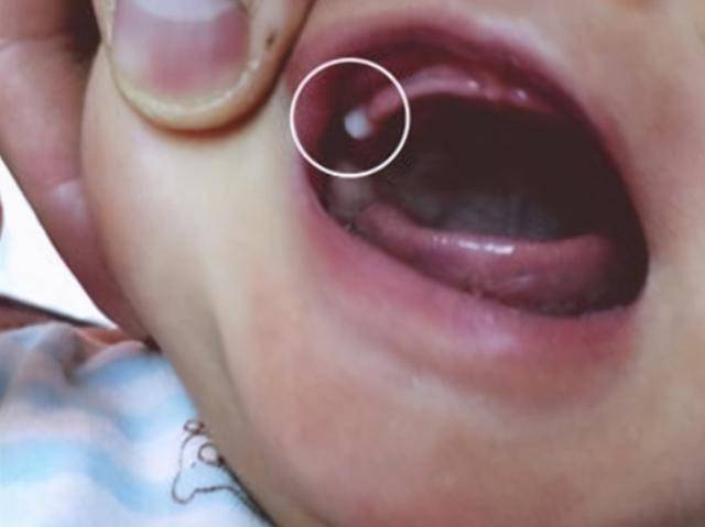 9个月宝宝没长牙宝妈被问责宝宝何时冒牙尖才正常
