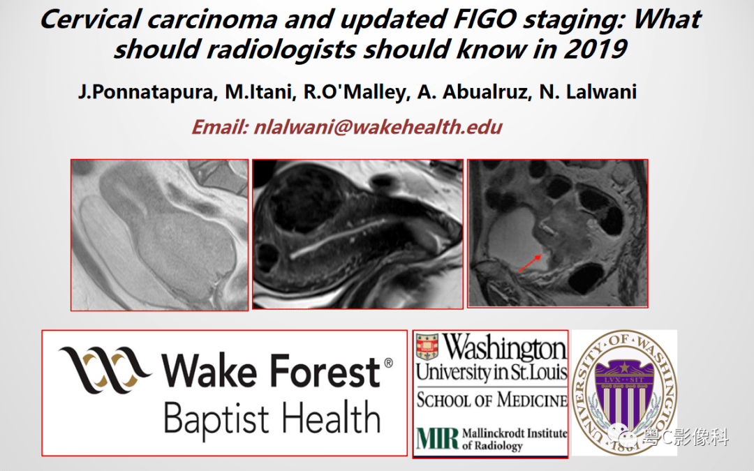 精彩推荐 宫颈癌最新figo分期 2019年影像医生须知 技术