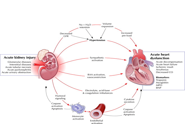 【产品推介】这是一篇心肾综合征全面分析的文章_患者
