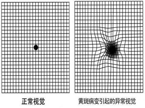 一张图自测眼健康,有图有真相