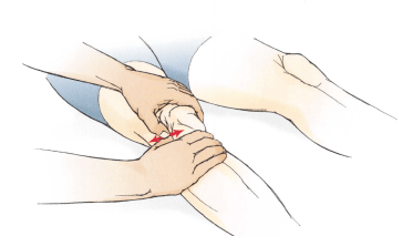 膝关节手法治疗Ⅱ