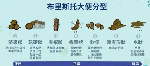 布里斯托大便分类法2现代医学认为,出现排便费力,排便次数减少,比如一