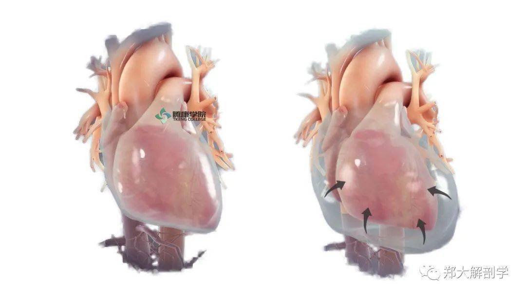 心脏压塞急性心包炎患者均应卧床休息,加强营养,维持水分及电解质平衡