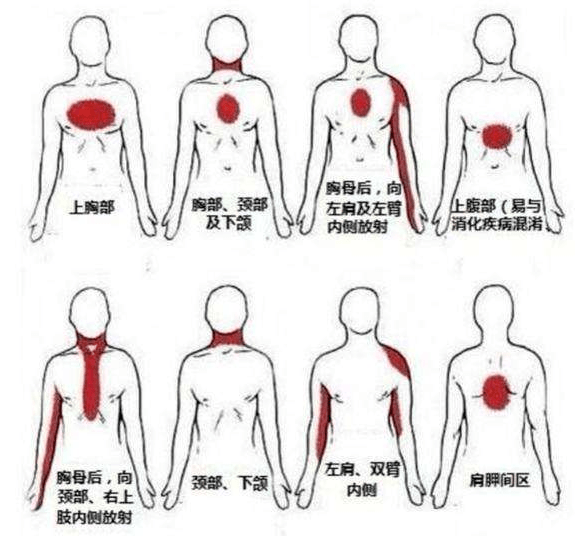 来自宁波的锦旗力证兰人医胸痛中心院后管理超满意!