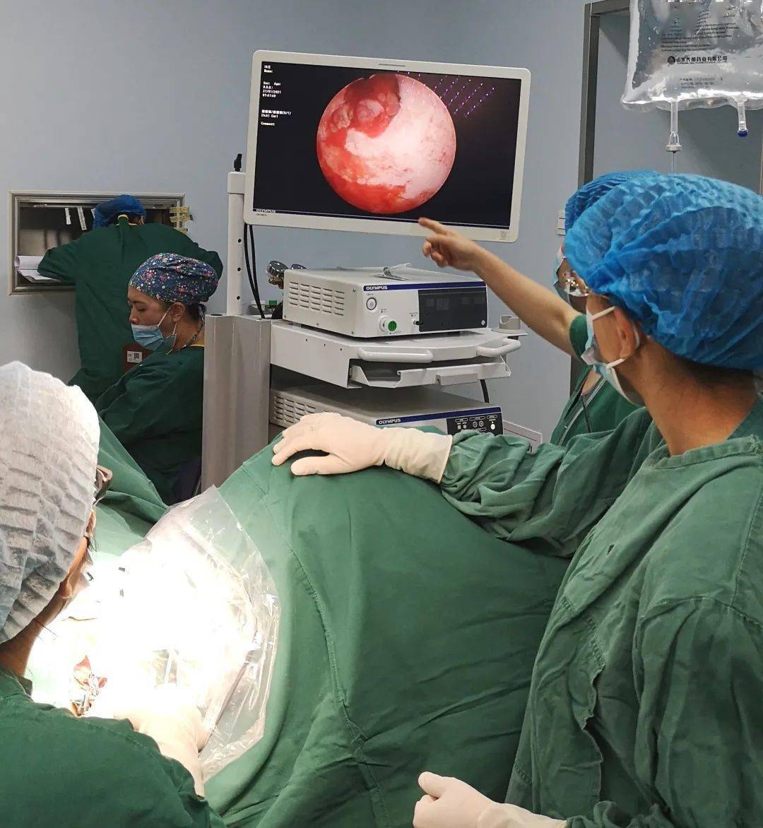 好消息澜沧县中医医院可以做宫腔镜啦