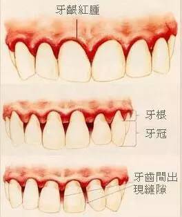 龈颊沟的位置图片图片