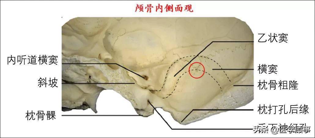 乙状窦体表定位图片