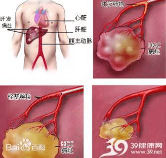 bfe2f3348317440f90130b16425d5f4a.png