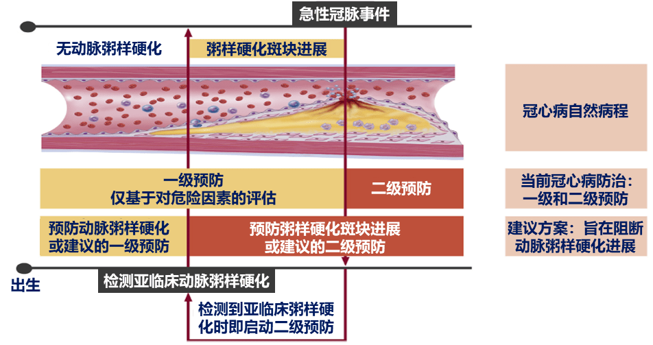 糖尿病学术前沿冠状动脉粥样硬化性心脏病治疗理念变迁从以斑块为中心