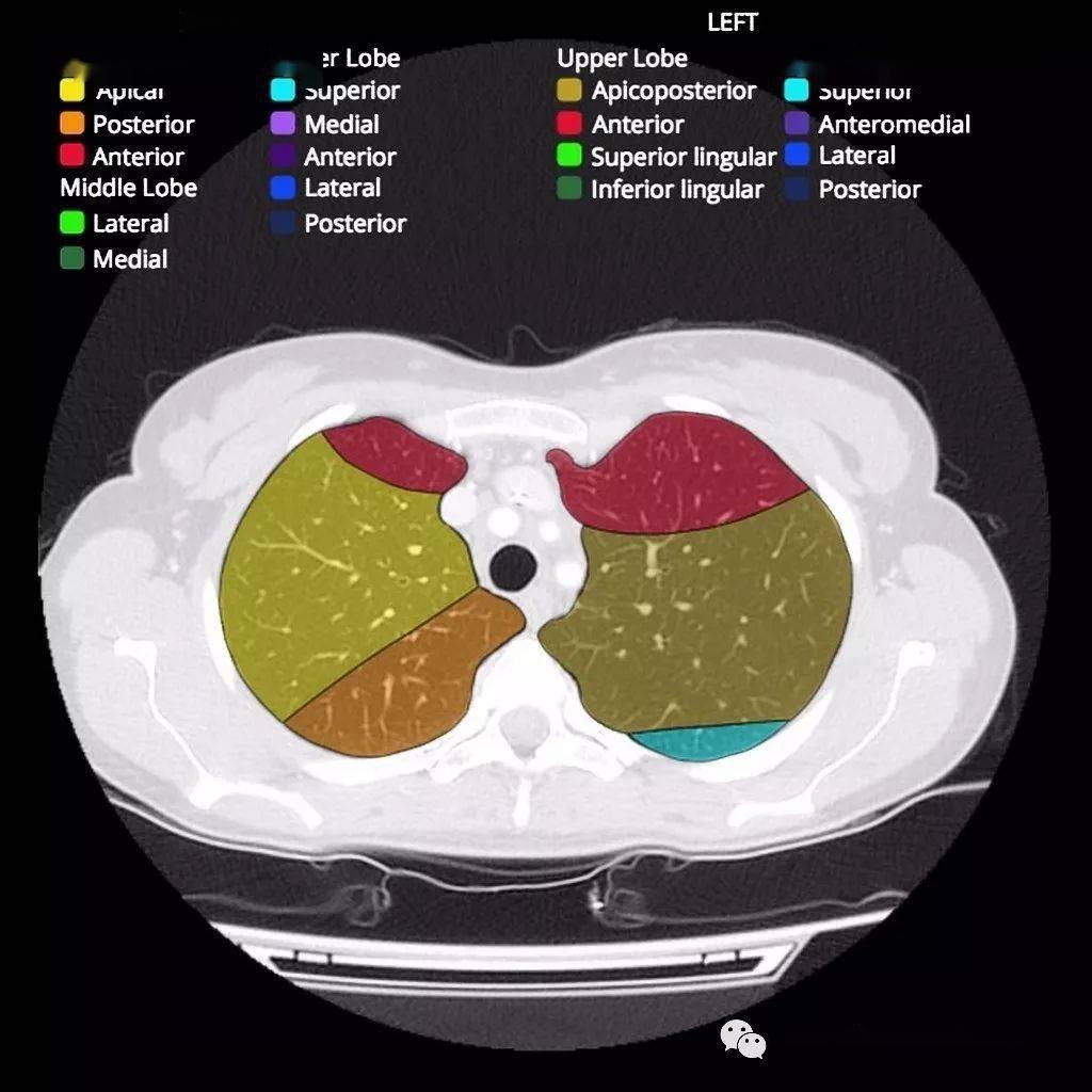ct肺段解剖(圖)