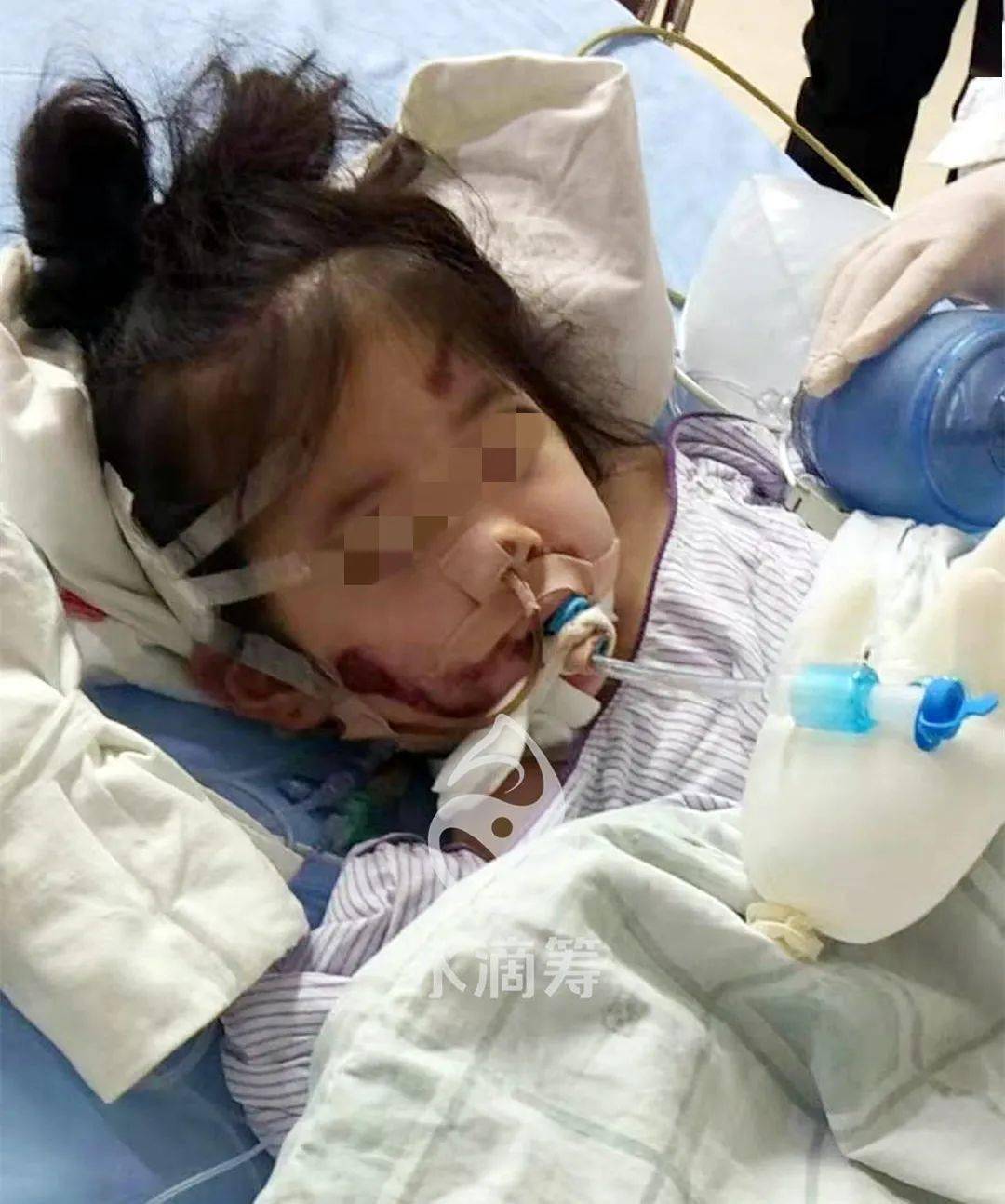 顺德惨烈车祸母亲身亡5岁女儿急需救命钱