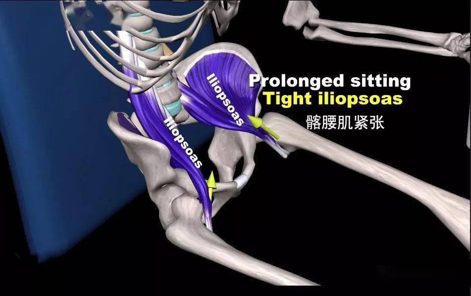 腰痛腰肌劳损你的髂腰肌需要拉伸和放松