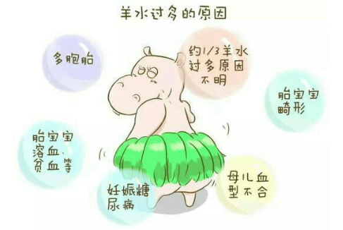 羊水过多知多少 胎儿