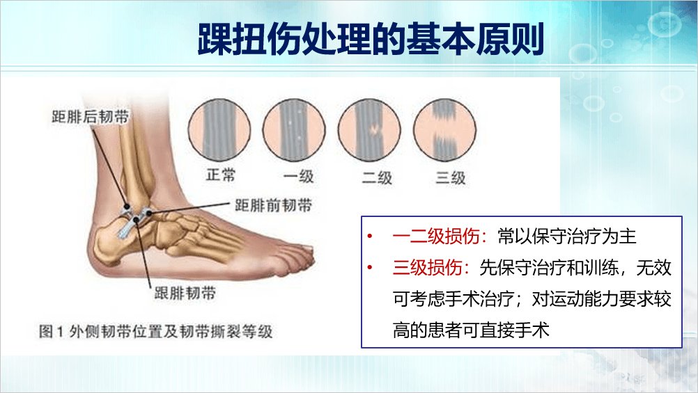 所有的 崴脚 都能保守治疗吗 韧带