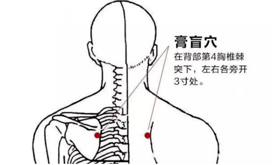 背痛怎么办