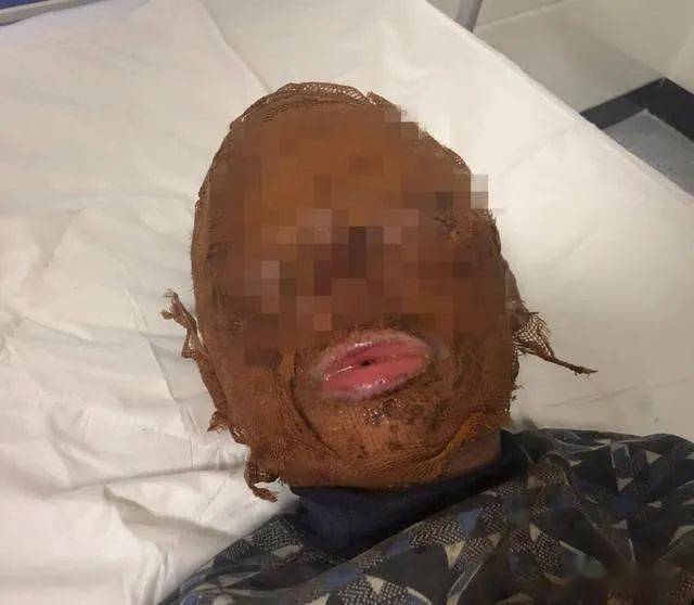 呐死都放烟花发生悲剧一炮毙命