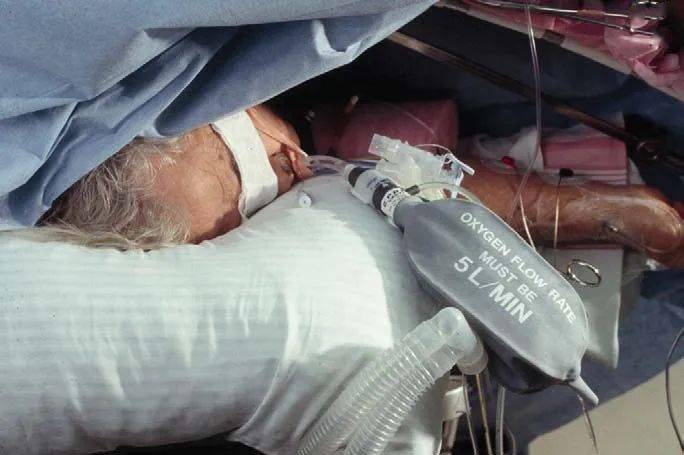 上海市胸科医院麻醉科单肺通气时低氧血症的处理