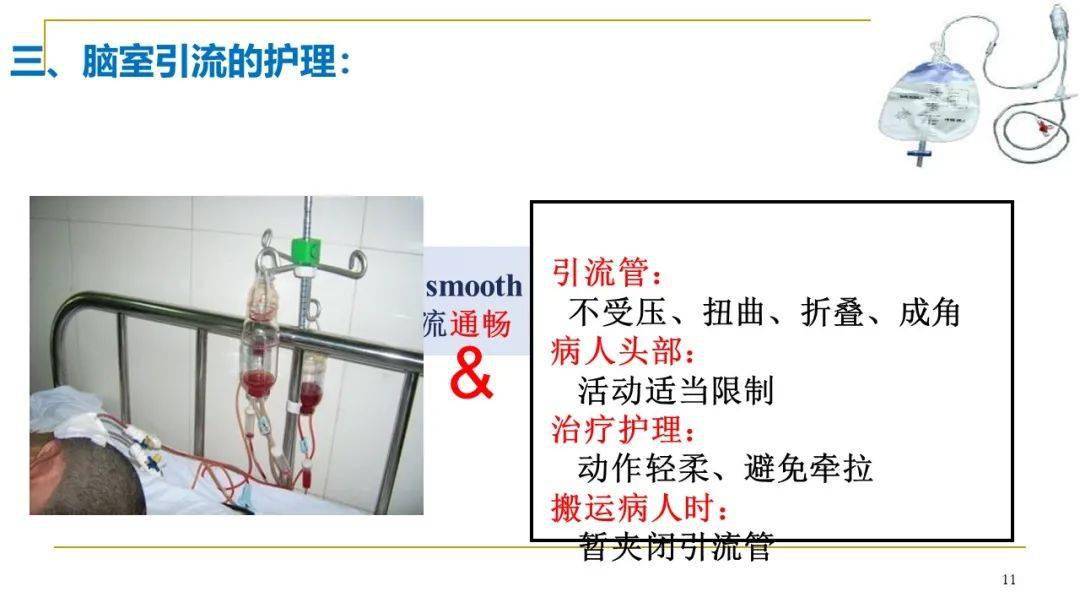 ppt脑室引流管的护理