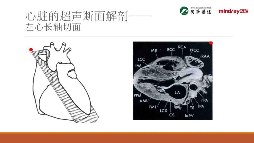 武汉同济医院麻醉科围术期经胸超声心动图tte