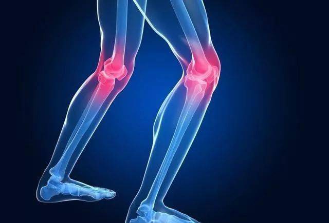 10条膝关节保护行为准则,运动时照着做