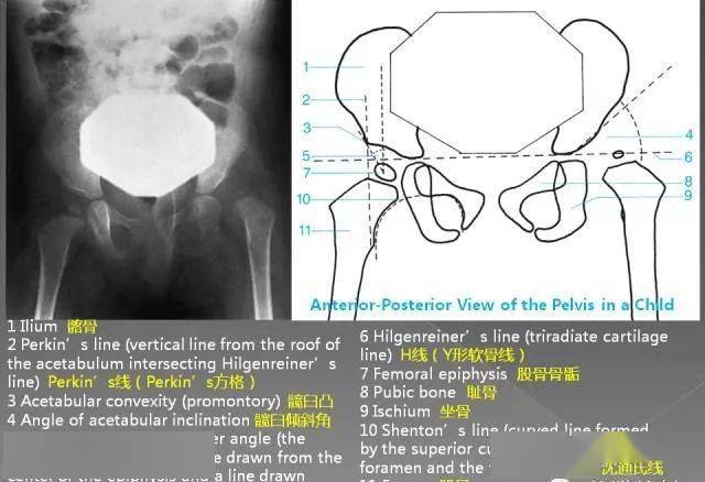 超詳細的腰椎x線解剖及解讀