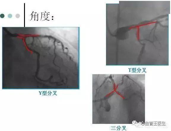 造影什么成语_正常输卵管造影图片