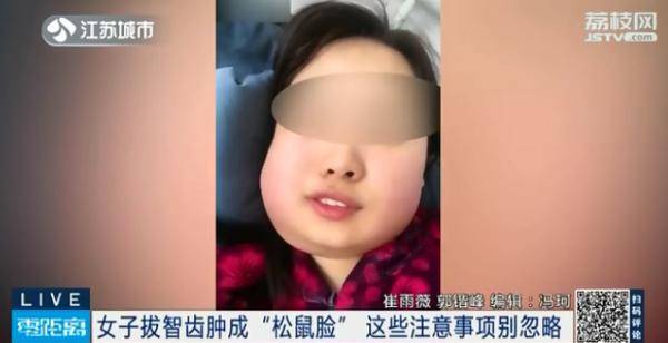 拔智齿 小手术 一时脸肿不可怕 最可怕的是 牙齿