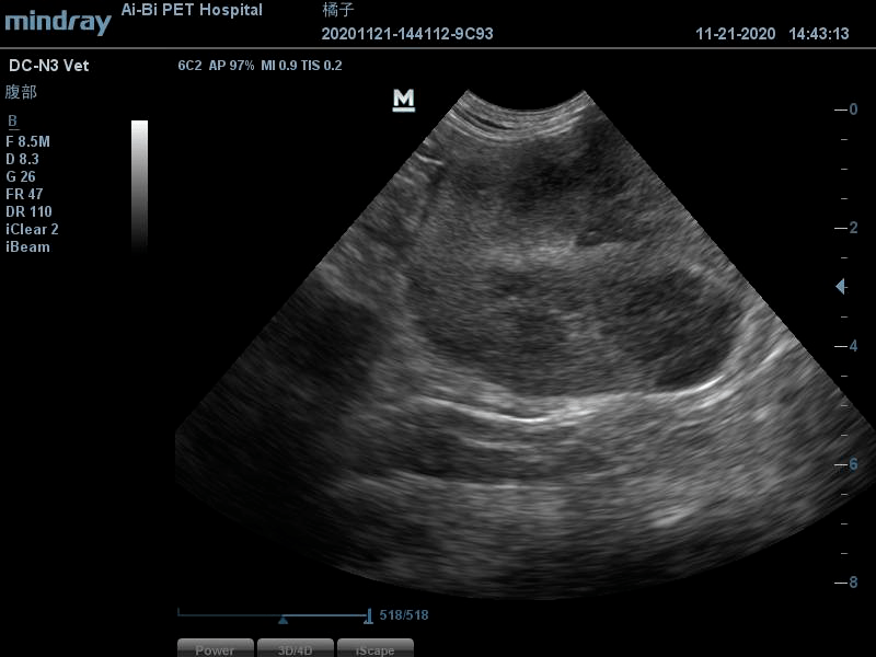 1cm;脾臟回聲正常,形狀扁平;肝臟回聲正常,邊緣銳利,膽囊充盈,膽汁