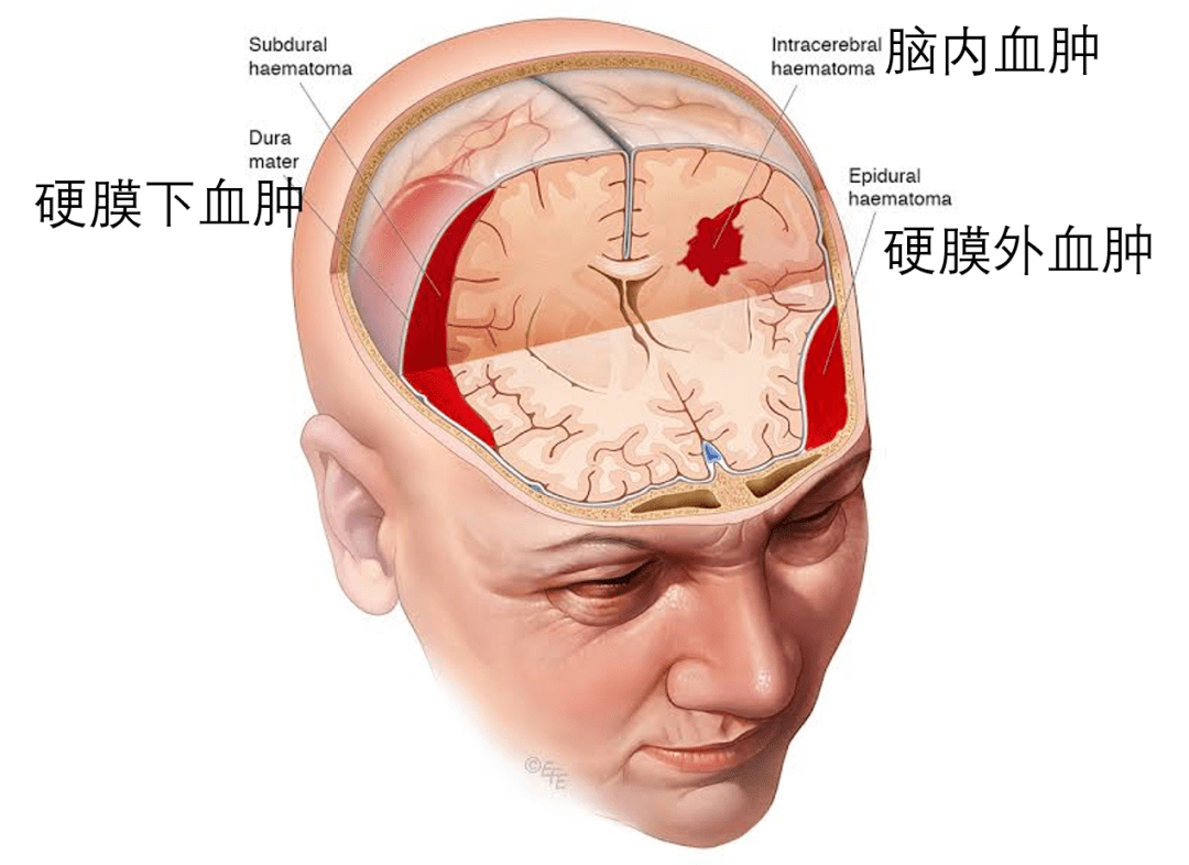 货拉拉搬家跳车身亡的姑娘果然是伤到了脑子