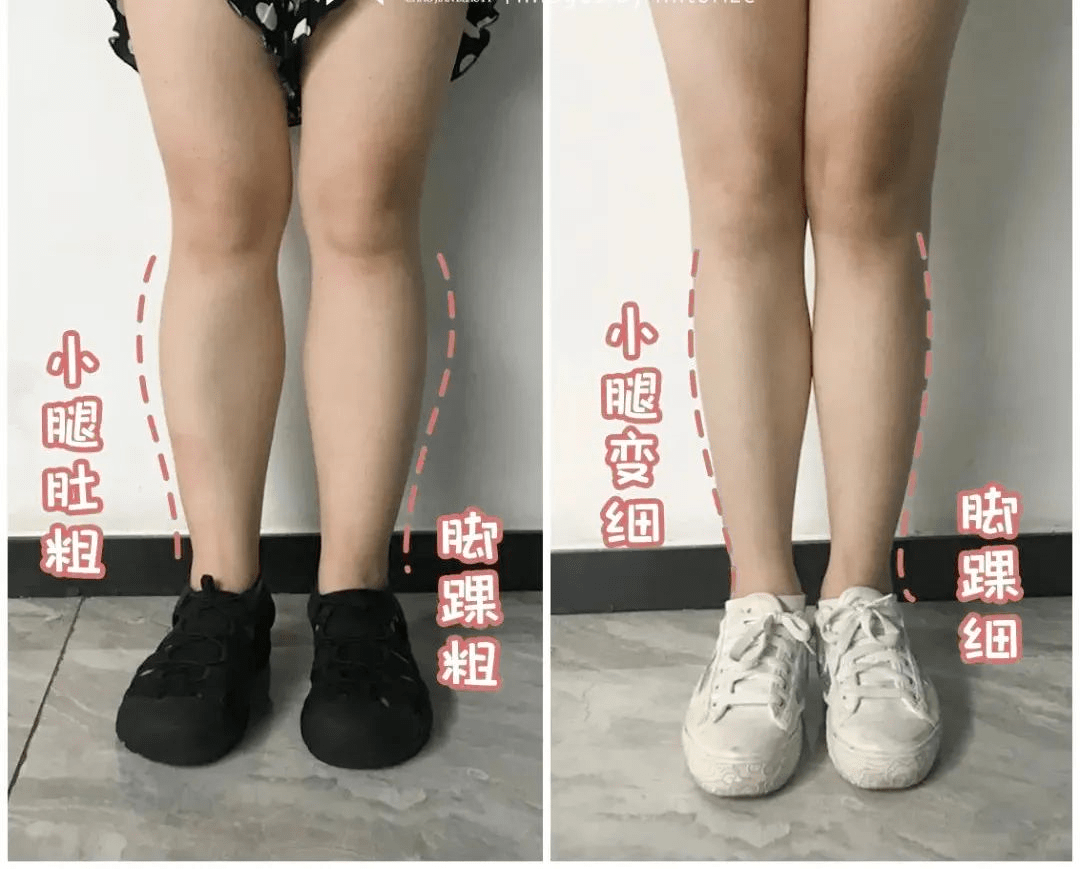 怎么样穿袜子才能显腿瘦 cb5f06db8f784d47b3cb8ece2a4debcf.png