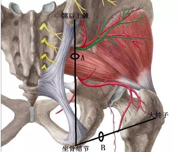 髂后上棘与坐骨结节之间的连线分为3等份,在其上,中1/3交接处做一点a