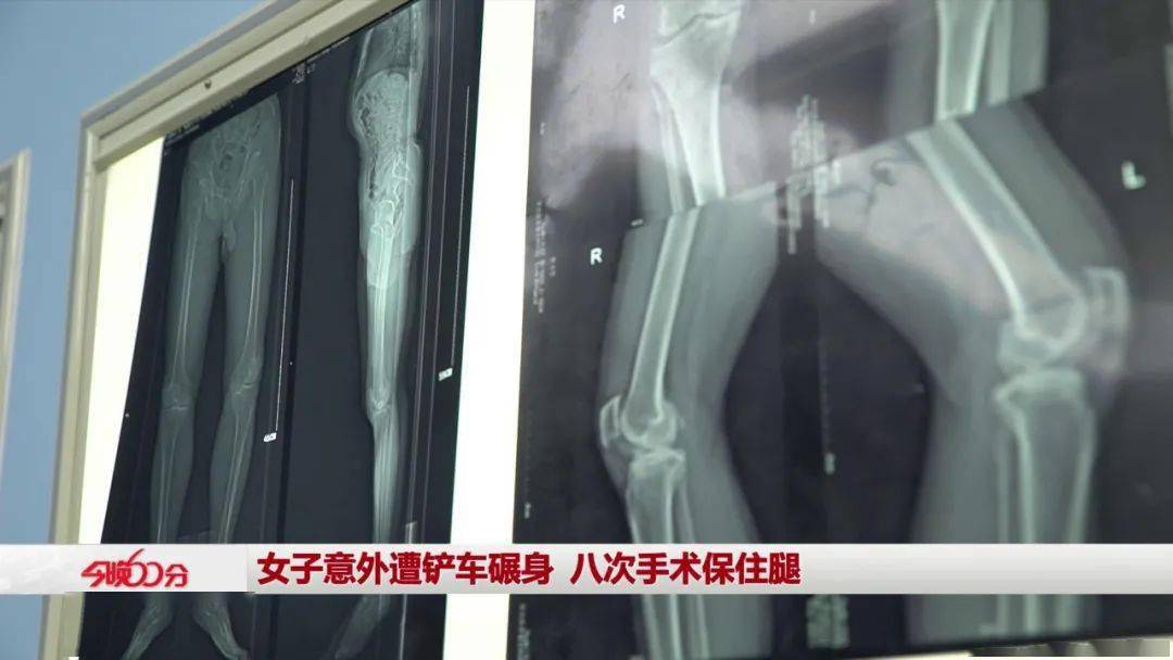 怎样才能长肉芽女性 f14042ac8d384c97b3562f66cbfb4cdc.jpeg