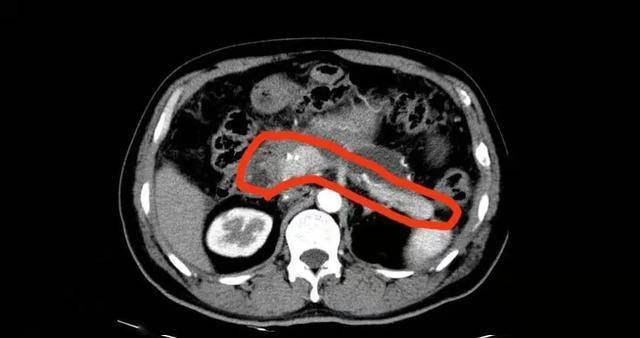 肺部积水什么问题 1520a10b358b449aaacfc8d58d068809.jpeg