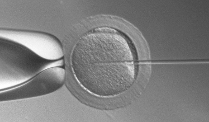 关于ICSI的那些事