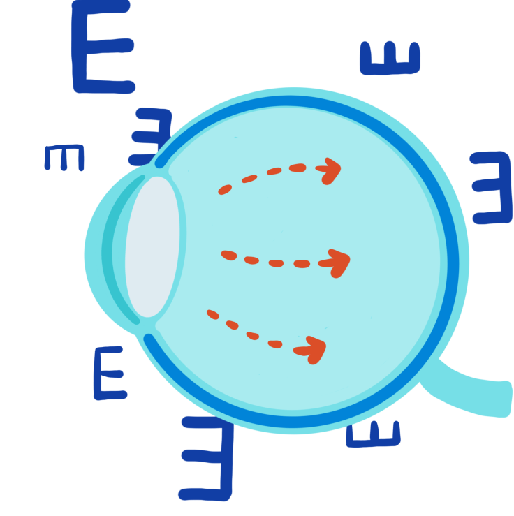 眼压检查有什么作用 64886f7cf5154a6ea23171794e3d4a71.png