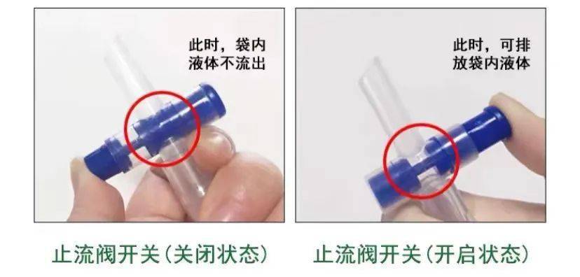 导尿管居家护理 您学会了吗 尿液