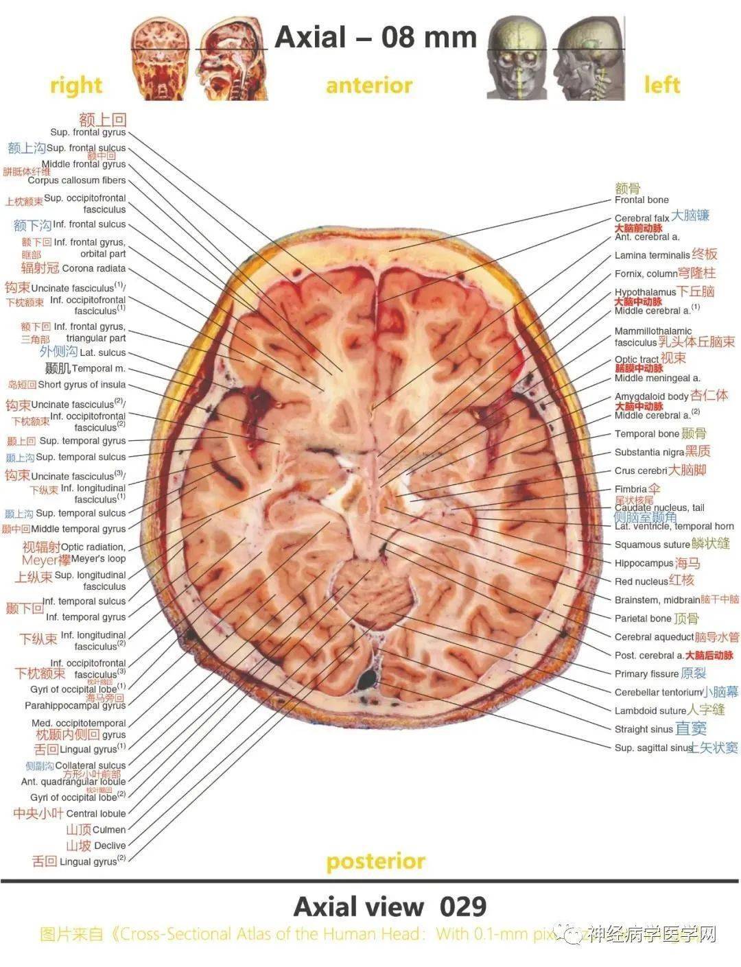 顱腦斷層解剖-高清