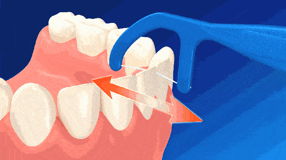 牙线动图图片