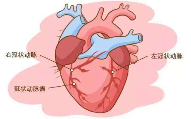 12天!1歲男孩反覆發燒不退,5步教你快速識別川崎病