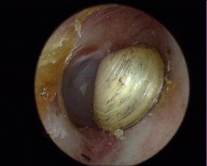 耳朵内部图片真实图片