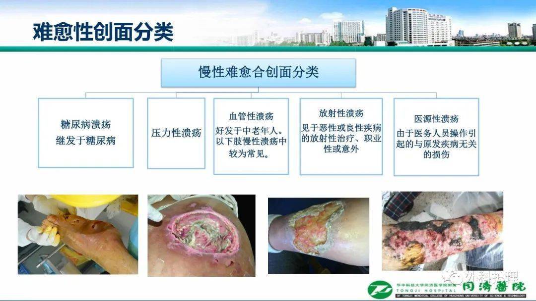 【ppt】一例慢性难愈合创面的案例分享_护理