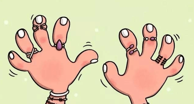 多图预警:手被门挤到"变形"时,到底有多痛?