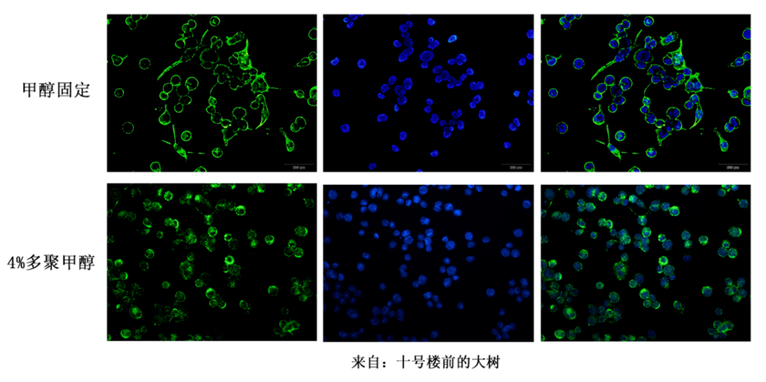 免疫荧光图片解读图片