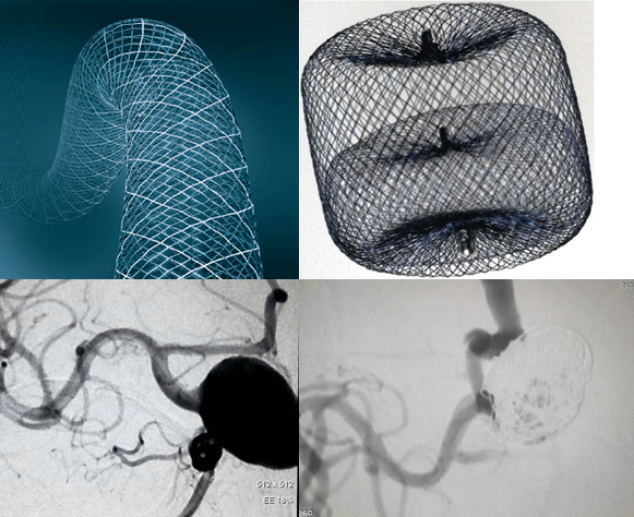 线上夜校正在播出(3月15日)李桂林主任:脑血管畸形