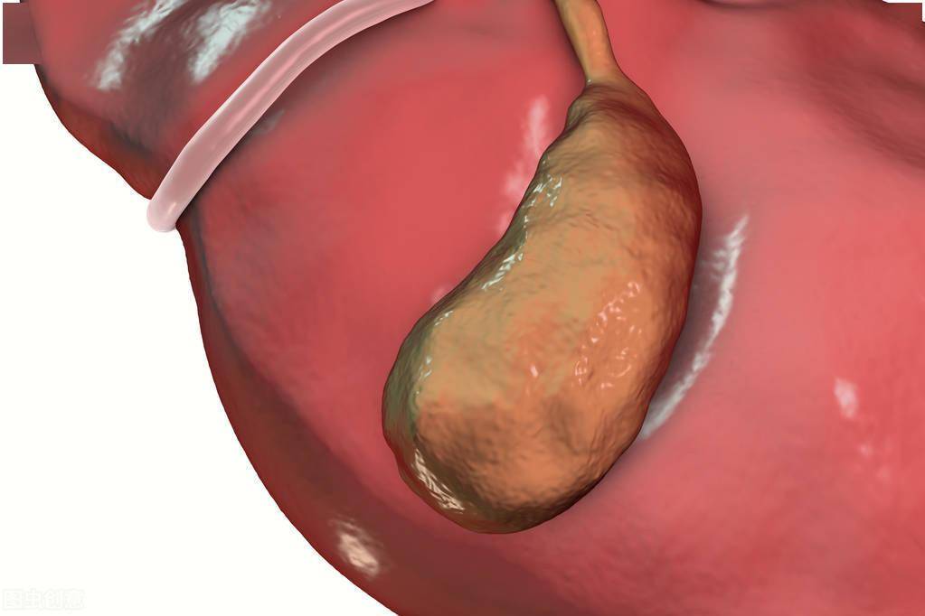 体检发现胆囊息肉怎么办 风险