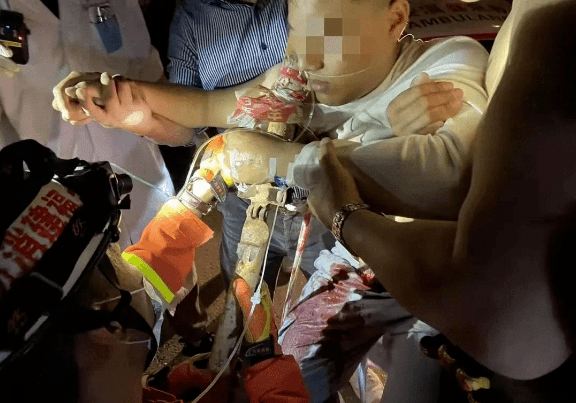 福建太吓人男子骑摩托车不慎撞上钢管右胸直接被刺穿