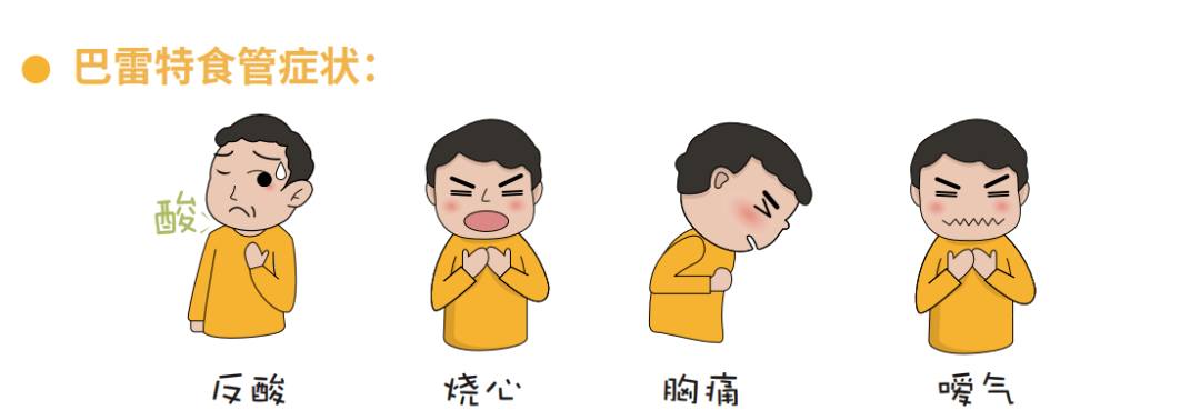 北平说科普一下barrett巴雷特食管可能你已中招