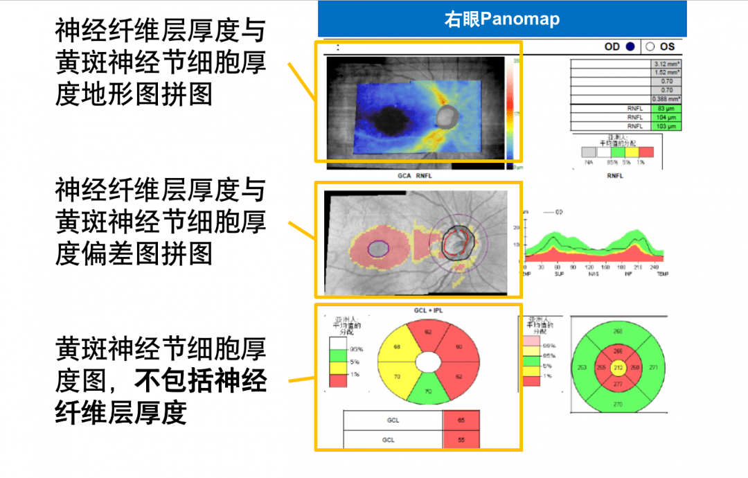 视盘结构图片